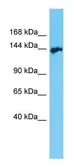Anti-AATK antibody, C-term used in Western Blot (WB). GTX16550
