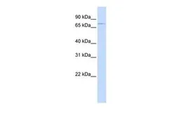 Anti-ABCB8 antibody, Internal used in Western Blot (WB). GTX16566