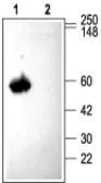 Anti-CACNB3 antibody used in Western Blot (WB). GTX16603