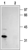 Anti-Stargazin antibody used in Western Blot (WB). GTX16605