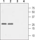 Anti-Cav gamma 5 antibody used in Western Blot (WB). GTX16626