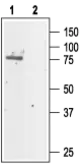 Anti-CLCN5 antibody used in Western Blot (WB). GTX16635