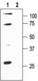 Anti-KCNN1 antibody used in Western Blot (WB). GTX16649