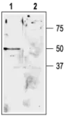 Anti-KCNK9 antibody used in Western Blot (WB). GTX16652