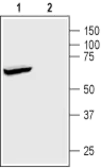 Anti-Trek1 antibody used in Western Blot (WB). GTX16653