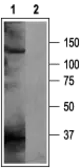 Anti-KCNH5 antibody used in Western Blot (WB). GTX16654