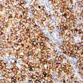 Anti-Placental Alkaline Phosphatase antibody [SP15] used in Immunohistochemistry (IHC). GTX16695