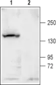 Anti-KCNT1 antibody used in Western Blot (WB). GTX16697
