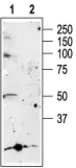 Anti-P2X5 antibody used in Western Blot (WB). GTX16812
