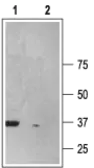 Anti-P2X6 antibody used in Western Blot (WB). GTX16843