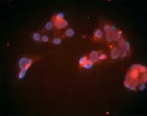Anti-LDL Receptor antibody [15C8] used in Immunocytochemistry/ Immunofluorescence (ICC/IF). GTX16897