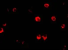 Anti-AES antibody used in Immunocytochemistry/ Immunofluorescence (ICC/IF). GTX16983