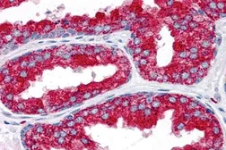 Anti-EMX2 antibody used in IHC (Paraffin sections) (IHC-P). GTX16990