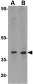 Anti-DHX58 antibody used in Western Blot (WB). GTX16995