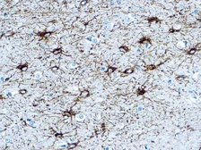 Anti-GFAP antibody used in IHC (Paraffin sections) (IHC-P). GTX16997