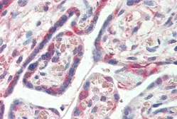Anti-PDLIM1 antibody, C-term used in IHC (Paraffin sections) (IHC-P). GTX17022
