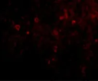 Anti-EBI3 antibody used in IHC (Paraffin sections) (IHC-P). GTX17036