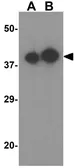 Anti-Apolipoprotein A4 antibody used in Western Blot (WB). GTX17091