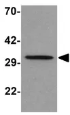 Anti-Apolipoprotein A5 antibody used in Western Blot (WB). GTX17120