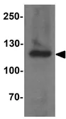 Anti-ERAP2 antibody used in Western Blot (WB). GTX17208