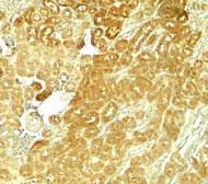 Anti-SMURF1 antibody used in IHC (Paraffin sections) (IHC-P). GTX17223