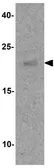 Anti-SPIB antibody used in Western Blot (WB). GTX17242