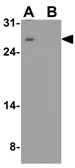 Anti-VTI1B antibody used in Western Blot (WB). GTX17253