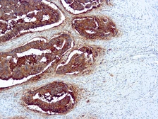 Anti-CD66e antibody[Col-1] used in IHC (Paraffin sections) (IHC-P). GTX17254