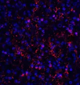 Anti-Orai1 antibody [3F6H5] used in IHC (Paraffin sections) (IHC-P). GTX17287