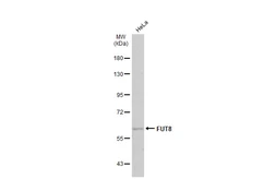 Anti-FUT8 antibody used in Western Blot (WB). GTX17311