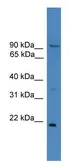 Anti-FOXM1 antibody used in Western Blot (WB). GTX17624