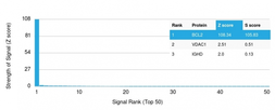 Anti-Bcl-2 antibody [BCL2/2210R] used in Protein Array (Protein Array). GTX17713