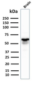 Anti-GAD67 antibody [GAD1/2391] used in Western Blot (WB). GTX17736