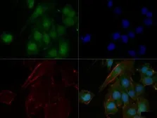 Anti-n-Myc antibody [NMYC-1] used in Immunocytochemistry/ Immunofluorescence (ICC/IF). GTX20057