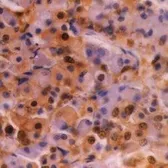 Anti-Ubiquitin antibody [1B4-UB] used in IHC (Paraffin sections) (IHC-P). GTX20122
