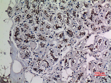 Anti-NFkB p65 (acetyl Lys218) antibody used in IHC (Paraffin sections) (IHC-P). GTX20307