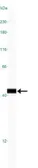 Anti-ARA9 antibody [35-2] used in Western Blot (WB). GTX20468