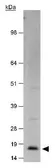 Anti-CDKN2A / p14ARF antibody used in Western Blot (WB). GTX20470