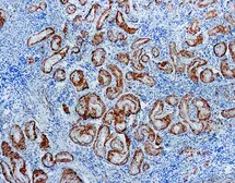 Anti-Calponin antibody [CALP (hCP)] used in IHC (Paraffin sections) (IHC-P). GTX20700
