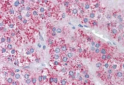 Anti-MTA1 antibody, Internal used in IHC (Paraffin sections) (IHC-P). GTX20751