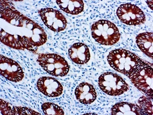 Anti-Cytokeratin 8 antibody [35βH11] used in IHC (Paraffin sections) (IHC-P). GTX20758