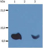 Anti-beta 2 Microglobulin antibody [236-12301 (B2M-01)] used in Western Blot (WB). GTX20759