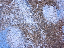 Anti-CD3 antibody used in IHC (Paraffin sections) (IHC-P). GTX20828