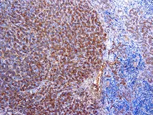 Anti-alpha 1 Antitrypsin antibody (ready-to-use) used in IHC (Paraffin sections) (IHC-P). GTX20922