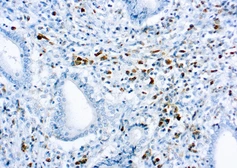 Rabbit Anti-Human kappa light chain antibody (ready-to-use). GTX20940