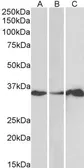 Anti-LASP1 antibody used in Western Blot (WB). GTX21301