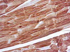 Anti-alpha Sarcomeric Actin antibody [5C5] (ready-to-use) used in IHC (Paraffin sections) (IHC-P). GTX21321