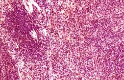 Anti-CCR6 antibody used in Immunohistochemistry (IHC). GTX21659