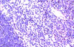 Anti-CCR9 antibody used in IHC (Paraffin sections) (IHC-P). GTX21662