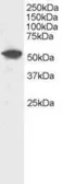 Anti-DUSP10 antibody used in Western Blot (WB). GTX22272